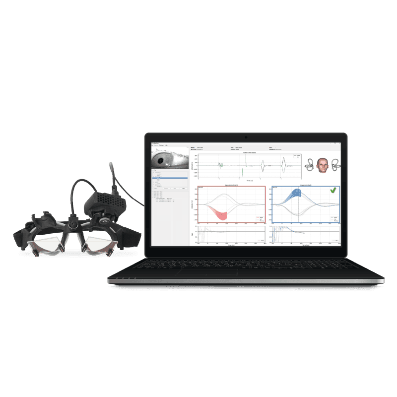 Interacoustics EyeSeeCam vHIT